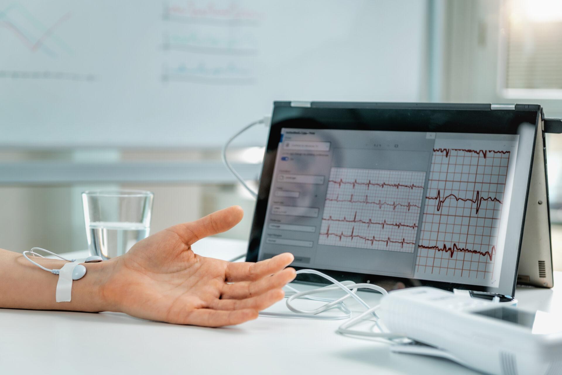 Hand with attached sensors for heart rate measurement.